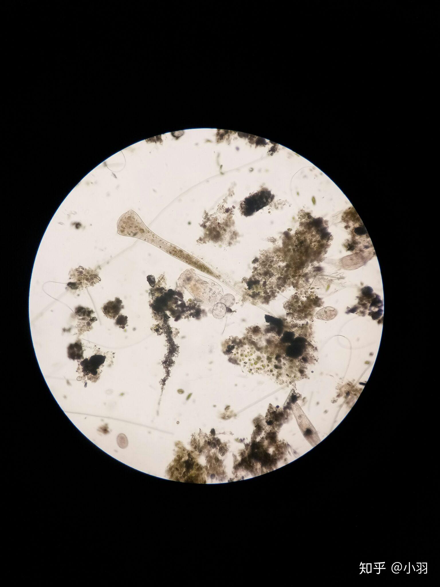 如何在野外找到天蓝喇叭虫(stentor coeruleus)? - 知乎