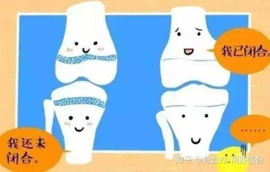 骨骼系统第1期——骨的形成与生长 - 知乎