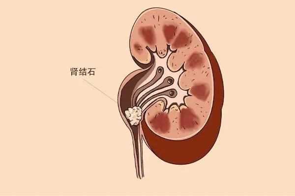 广州狐臭医院：走出困扰与误区