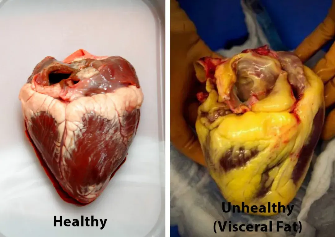 内脏脂肪超高严重如何短期内减掉内脏脂肪并提高基础代谢率