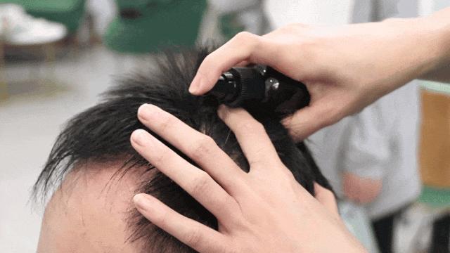 泡沫型米诺的效果比液体型米诺好？ - 知乎