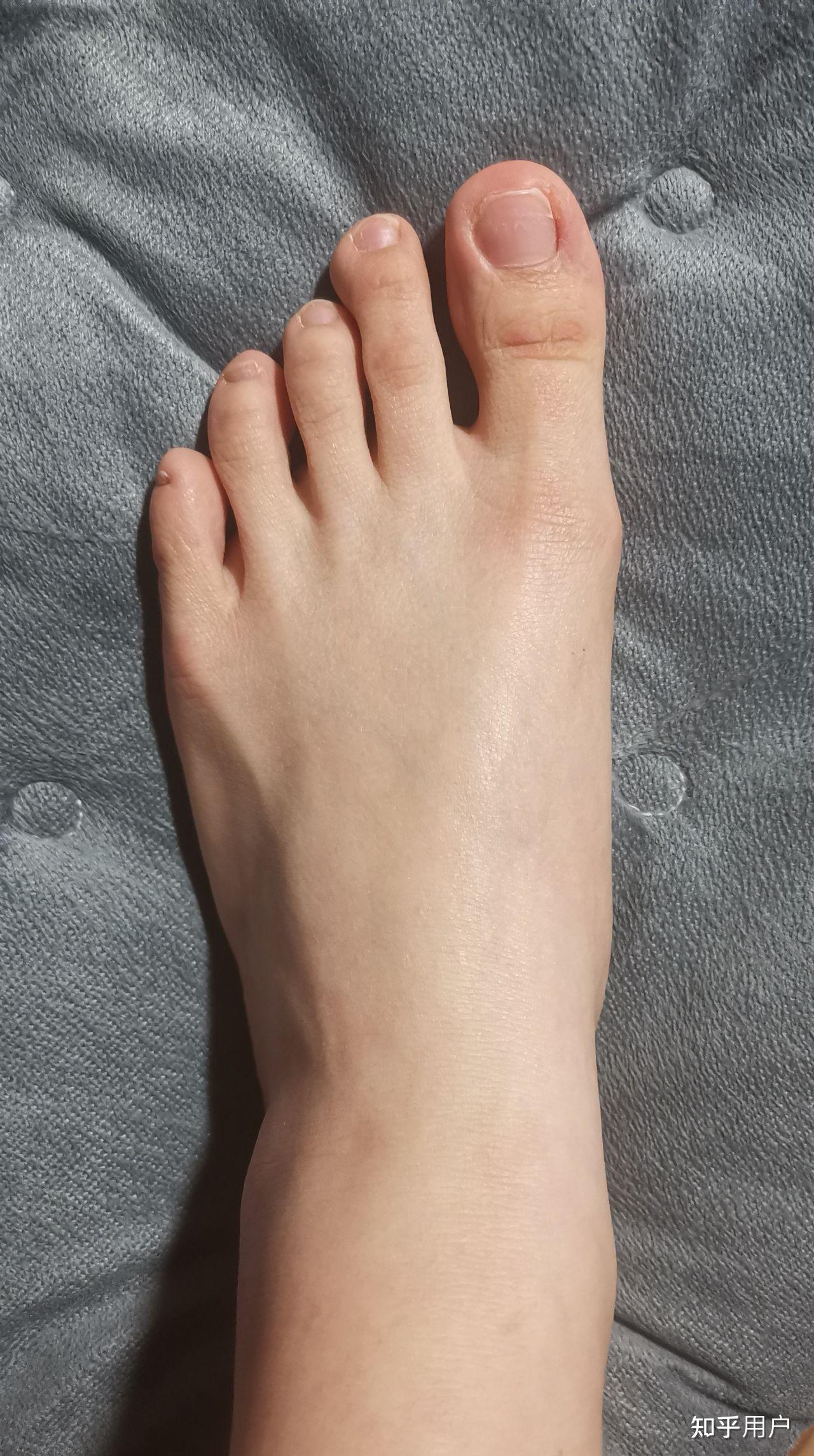 脚趾长好还是短好? - 知乎