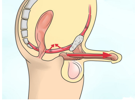 男性锻炼pc肌强度应如何控制?