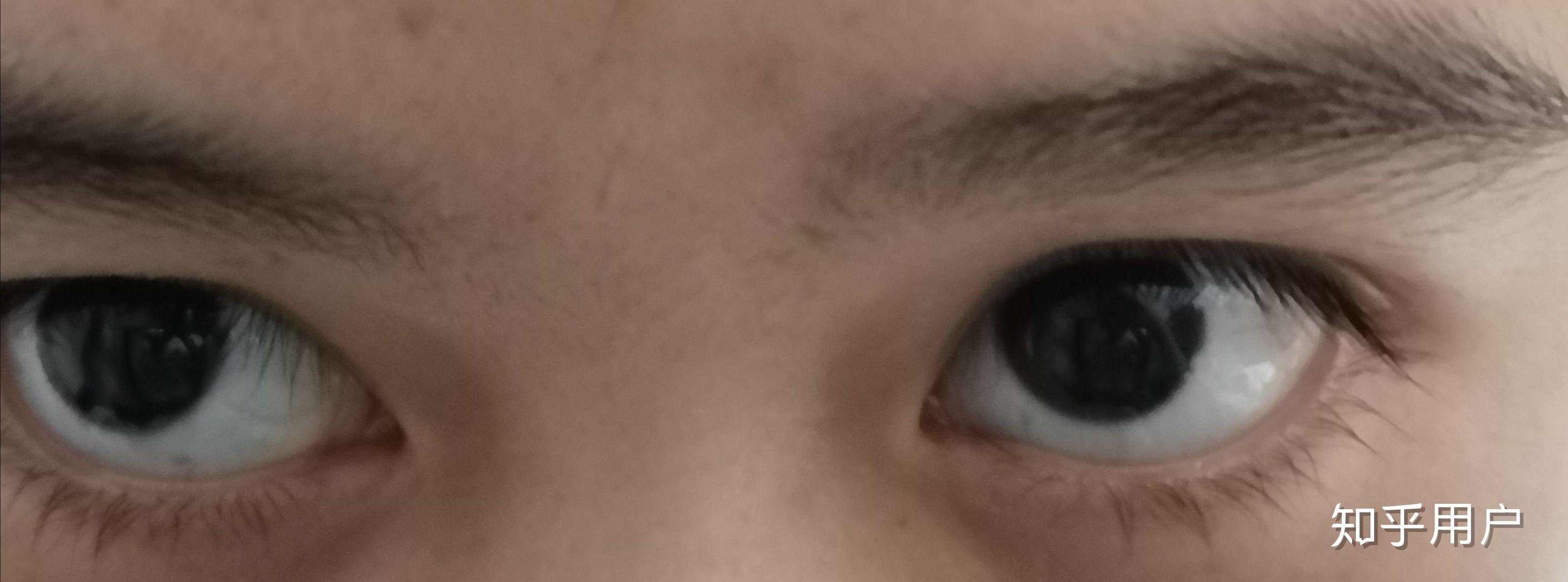 中国人眼球不是黑色么为什么好多人是棕色的我就是还有其他颜色吗