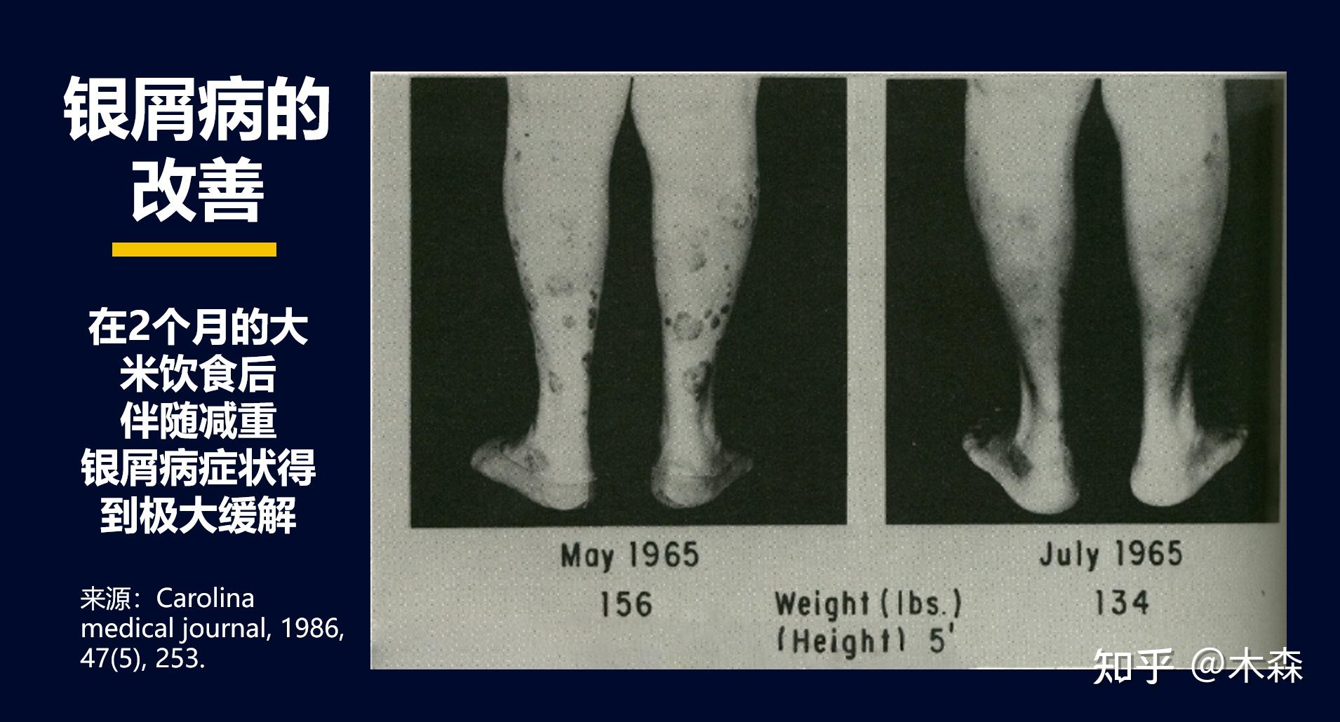 每天只吃米饭或者每天只喝白米粥坚持一个月后会发生什么