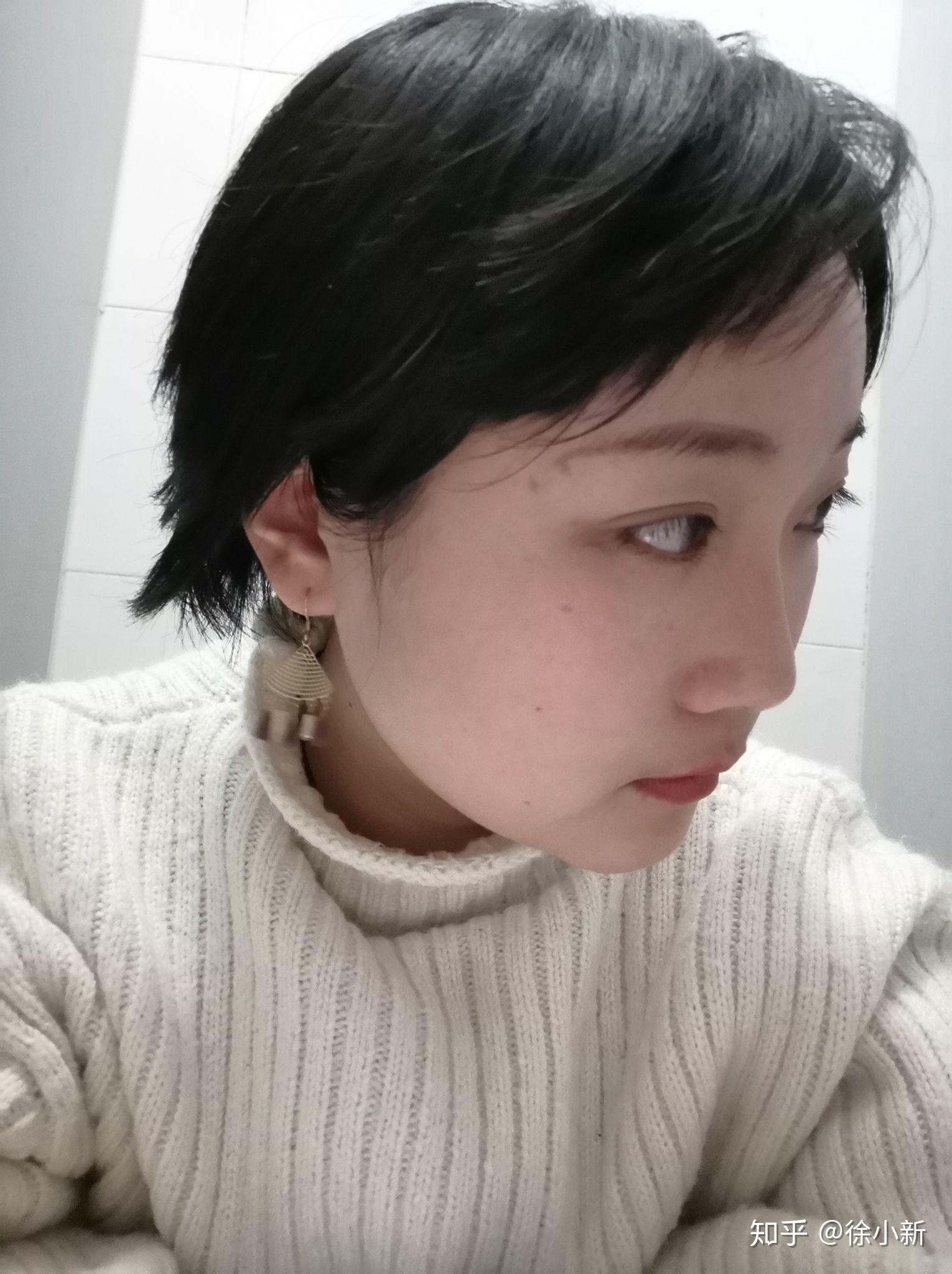 内双怎么用按摩等自然方法变成外双? - 知乎
