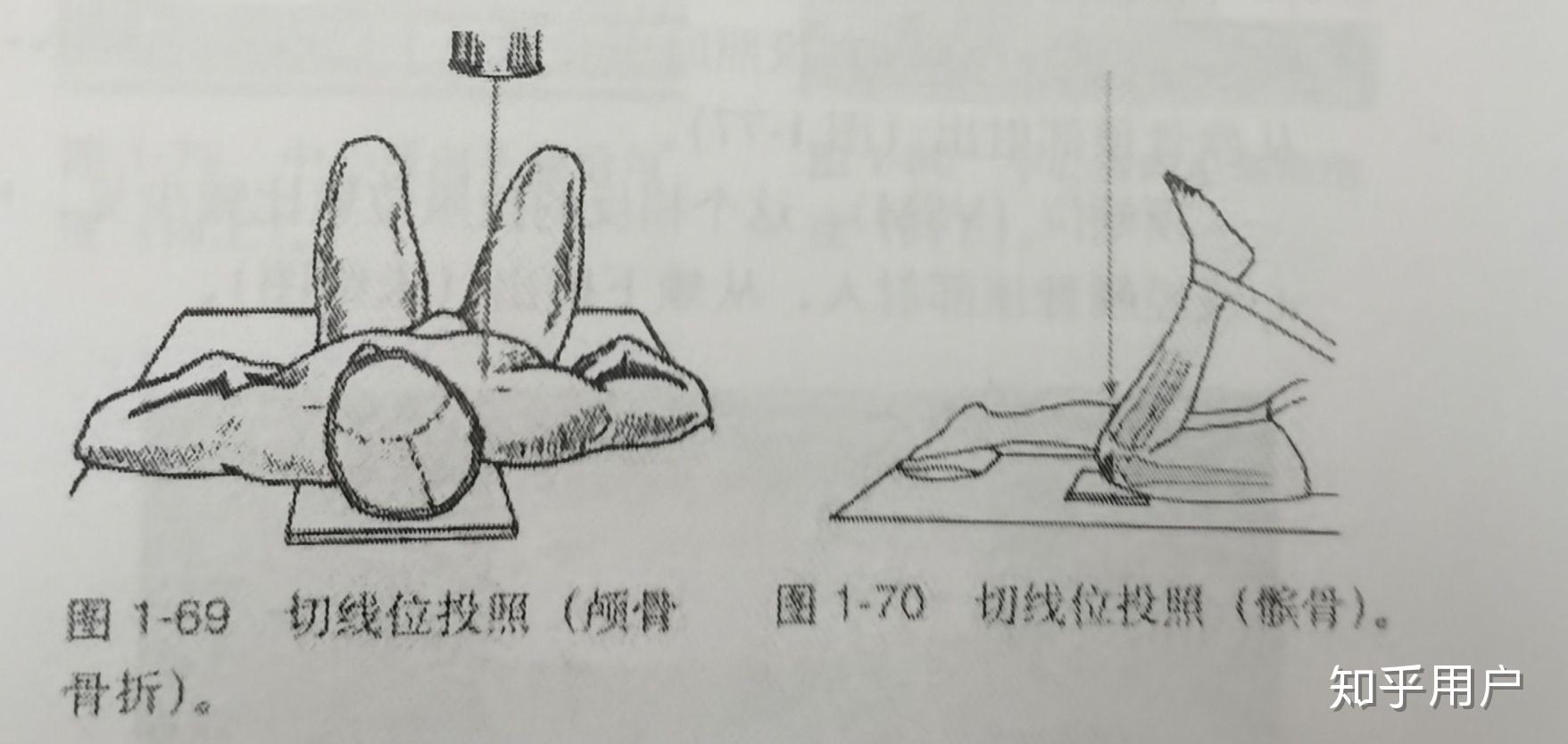 影像学上的切线位是啥意思啊