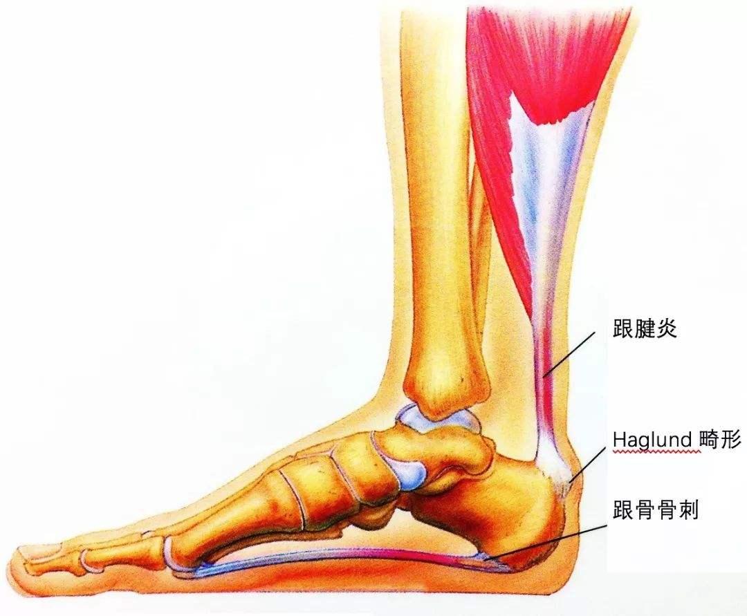 脚根图片