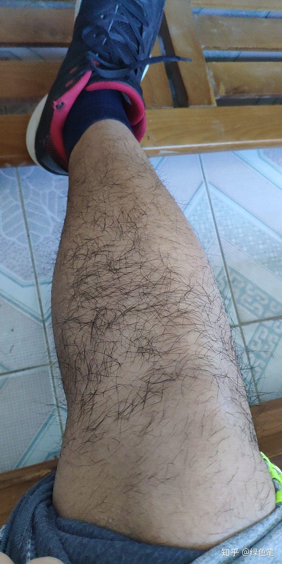 腿毛 真实图片