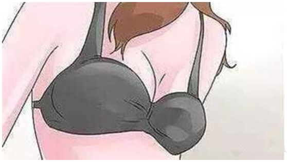 为什么有些女生的两个乳房大小差异这么大