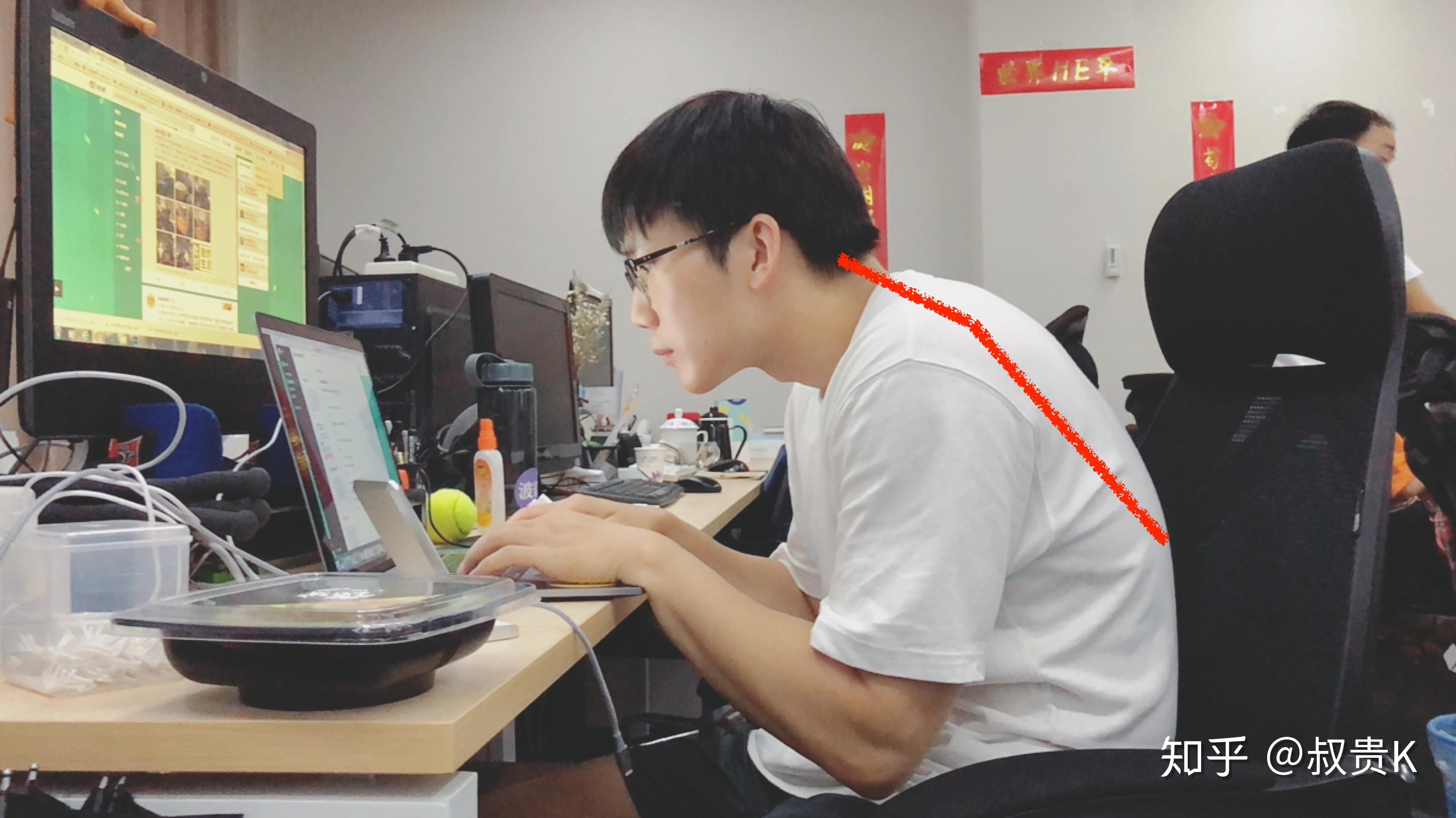 脖子前倾怎么矫正