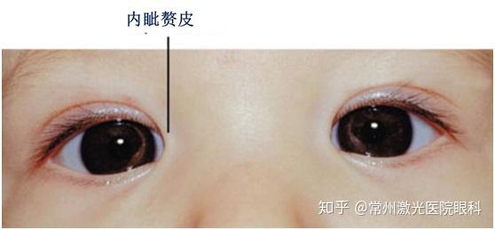 关于眼睛健康的事实 - 知乎