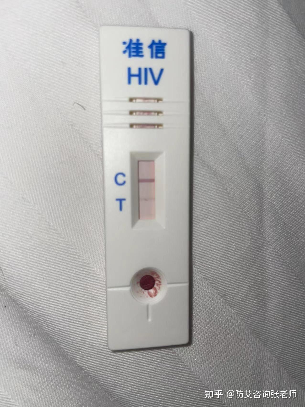 准信试纸,请大家帮忙看看这是包埋线还是什么?