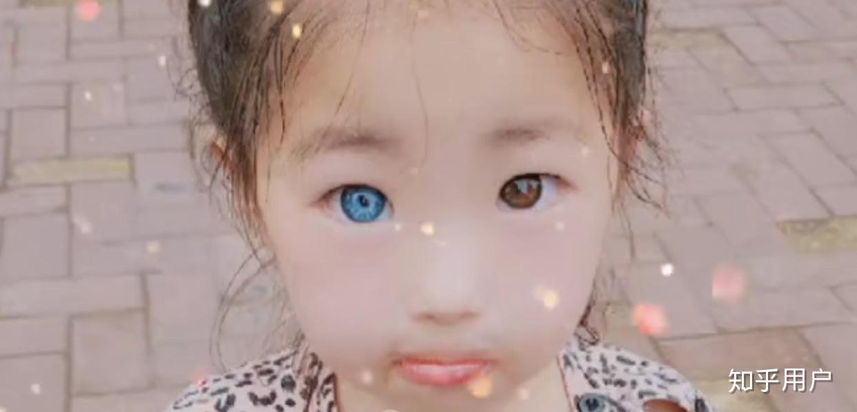 现实生活中真的有异瞳人么? - 知乎