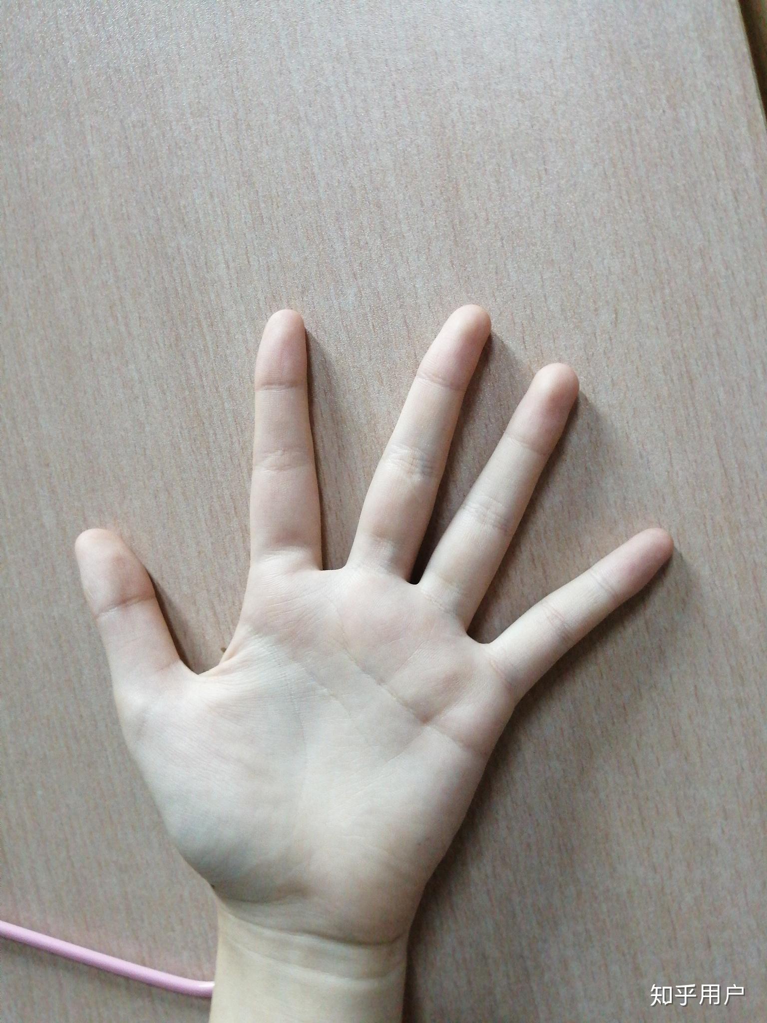 手指太胖怎么办?如何能给手指减减肥? - 知乎