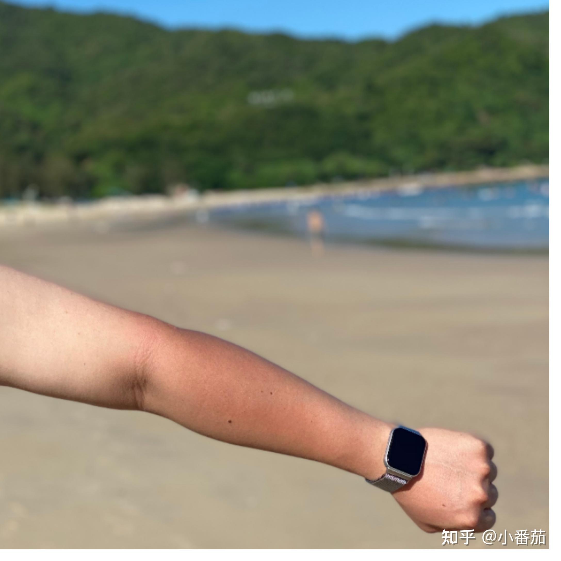 暴晒之后皮肤很红怎么办? - 知乎