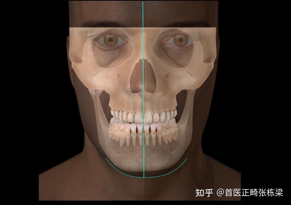 偏颌是怎样一种体验? - 知乎