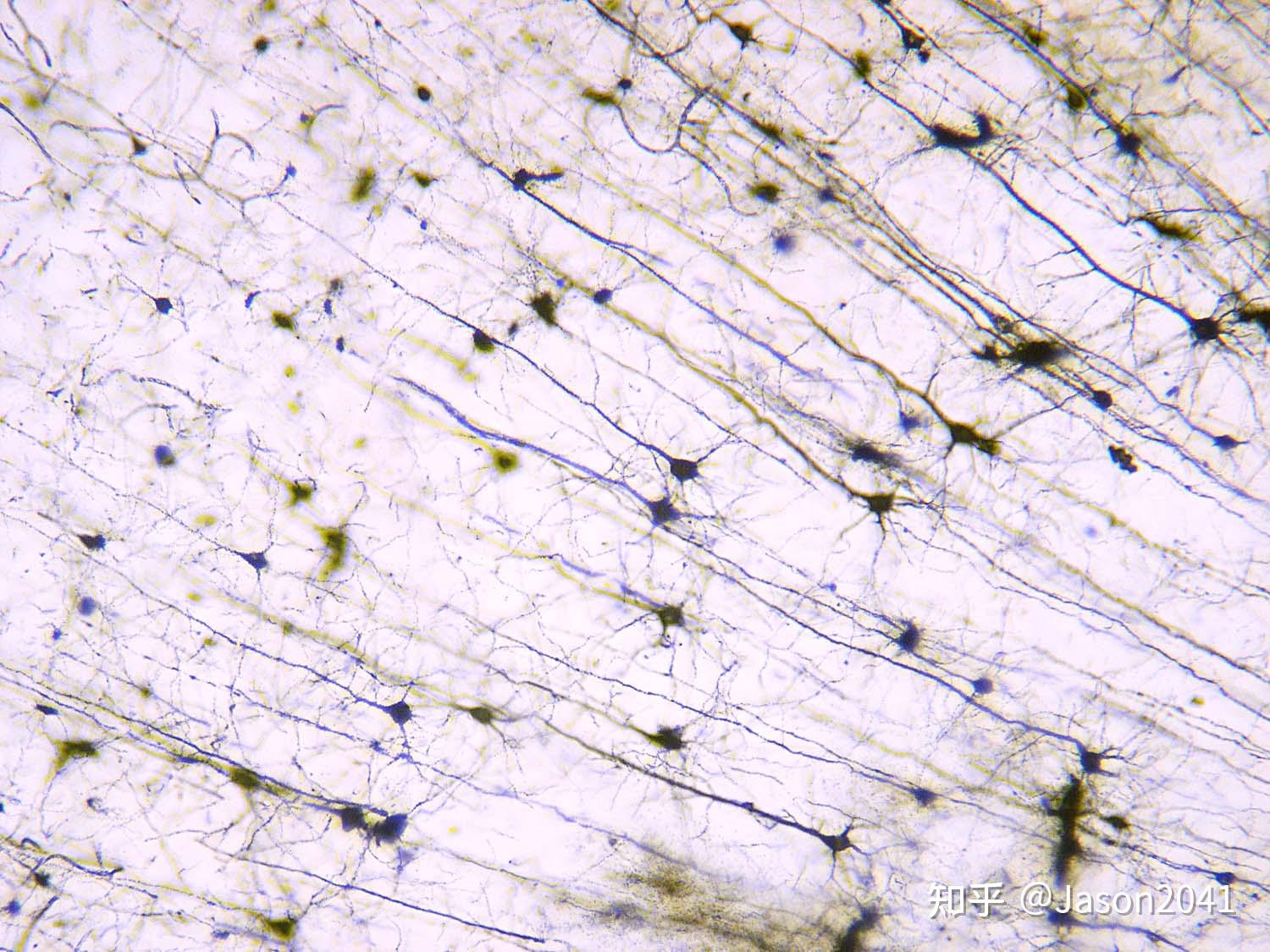 神经原纤维光镜图图片