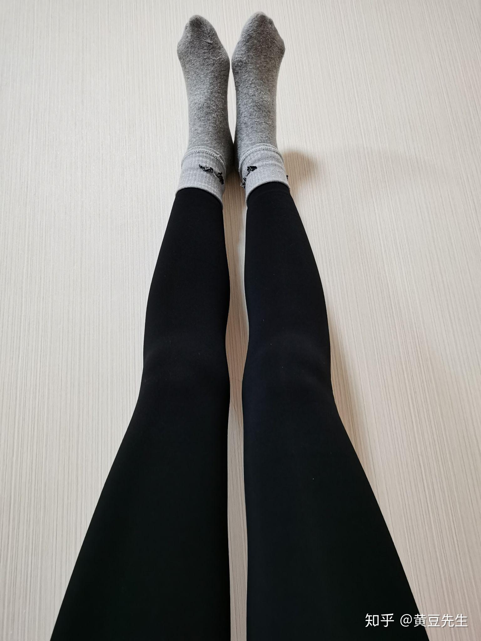 腿型很奇怪腿很细但是腿部膝盖部位骨头内侧很突出请问有矫正的方法吗