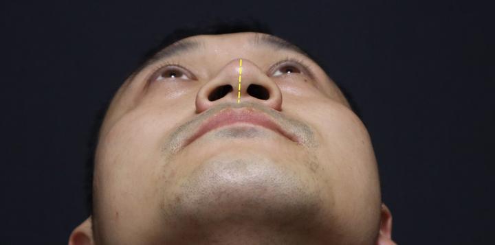 歪鼻还能 拖 出鼻炎 医生提醒 4种情况 是鼻子向你 呼救 知乎 歪鼻还能 拖 出鼻炎 医生提醒 4种情况 是鼻子向你 呼救 知乎
