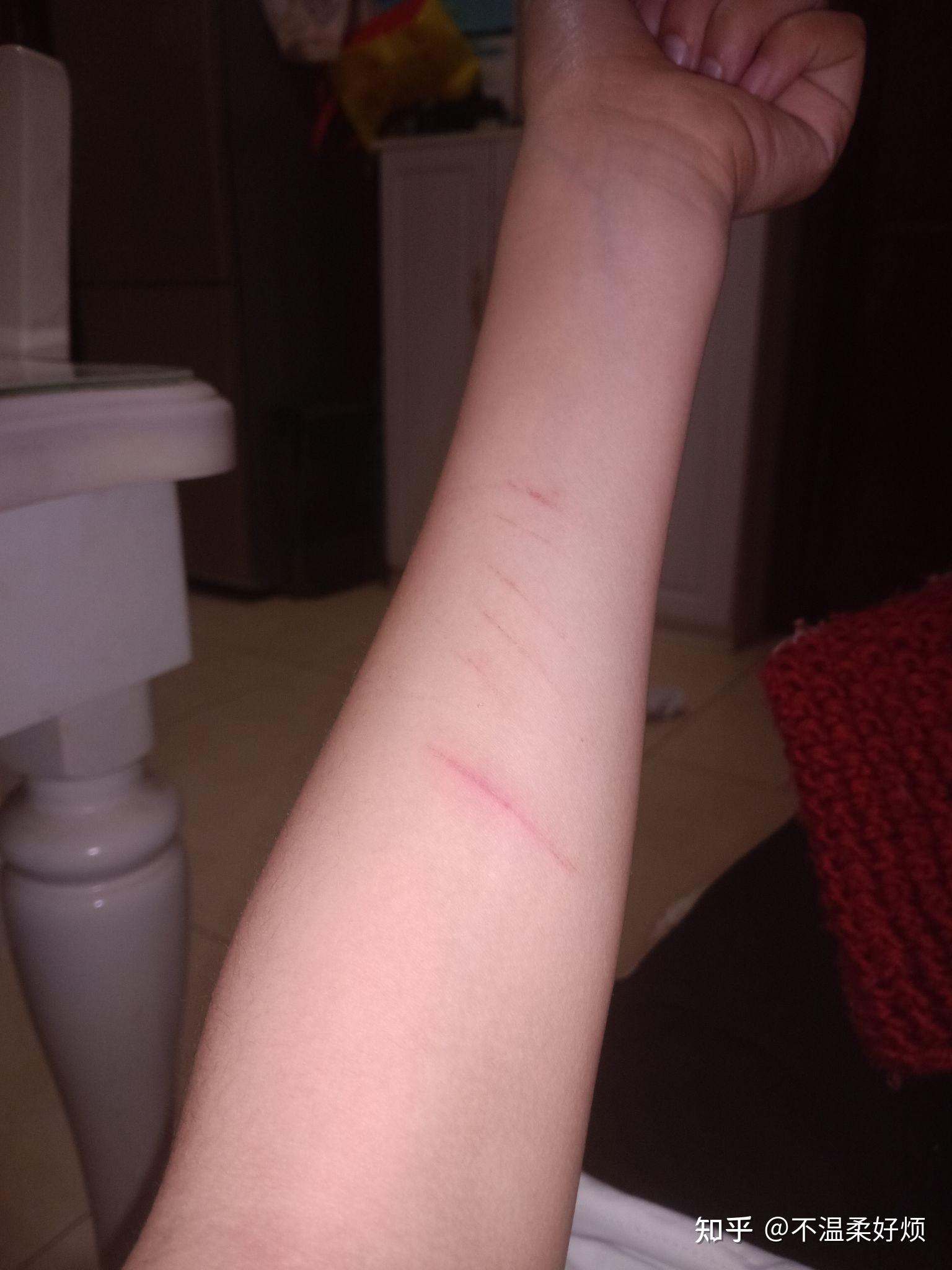 不是很懂,为什么初中生喜欢拿刀在胳膊上画?