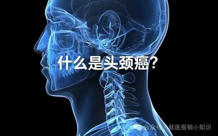 什么是头颈癌? - 知乎