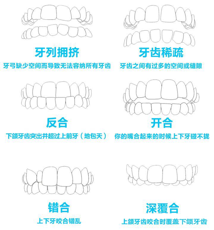 牙齿矫正方法那么多,哪种适合你? - 知乎