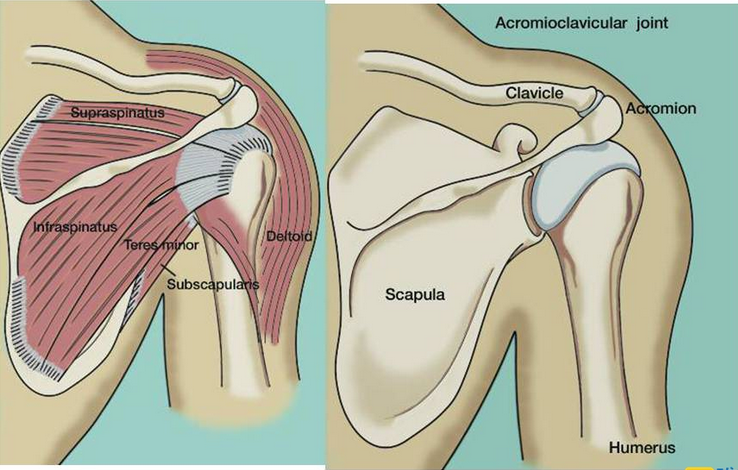 肩锁关节韧带损伤怎么恢复