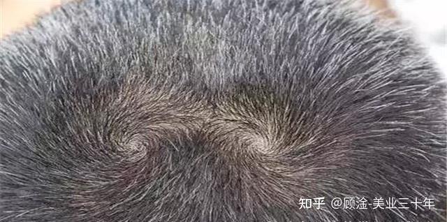 我的这个发旋处的发量是正常的吗？ - 知乎