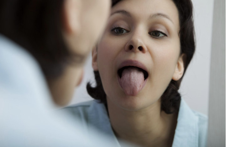 快、看看你的舌头是否健康 - 知乎