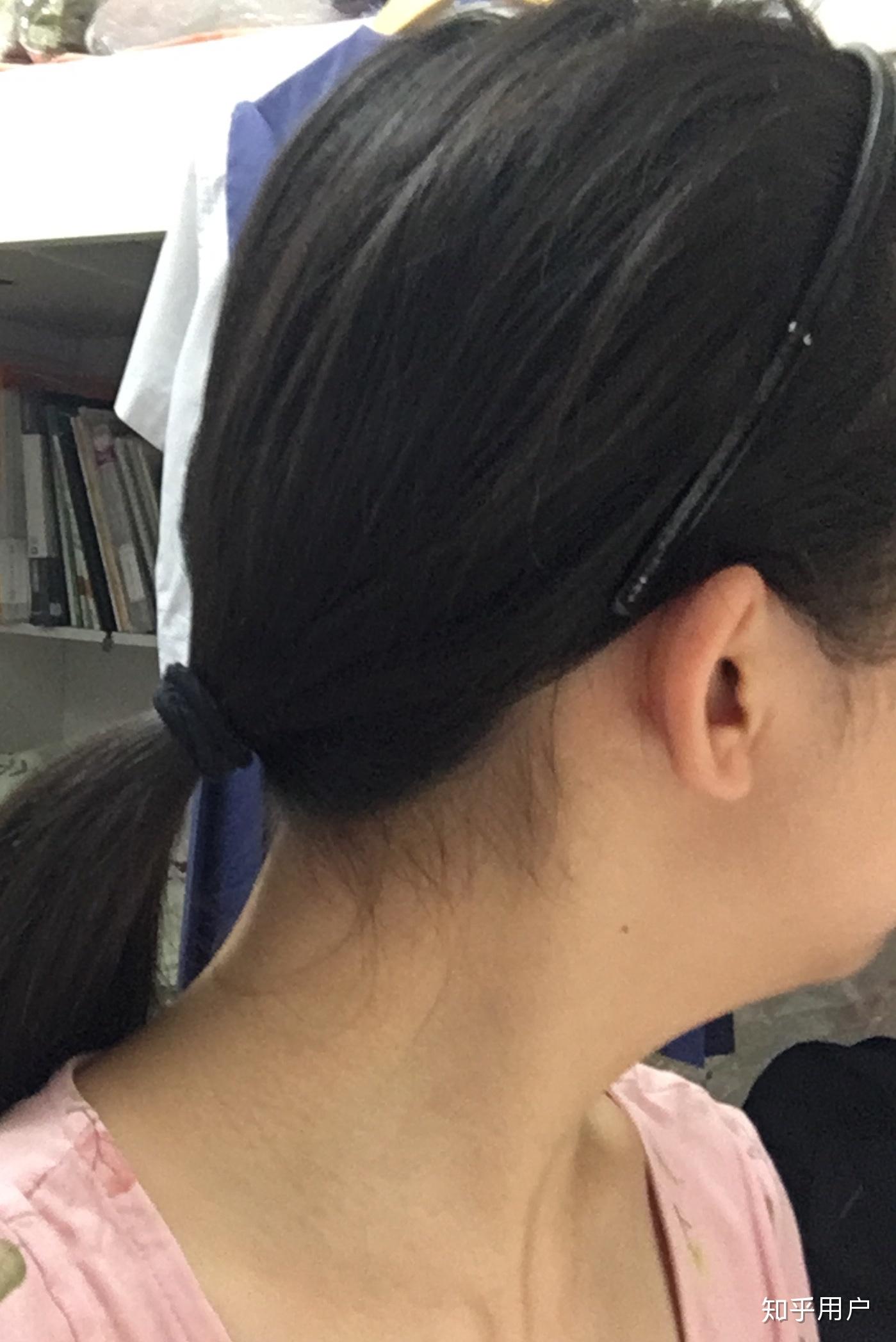 扁头,骨相不好看的女生如何改造自己?