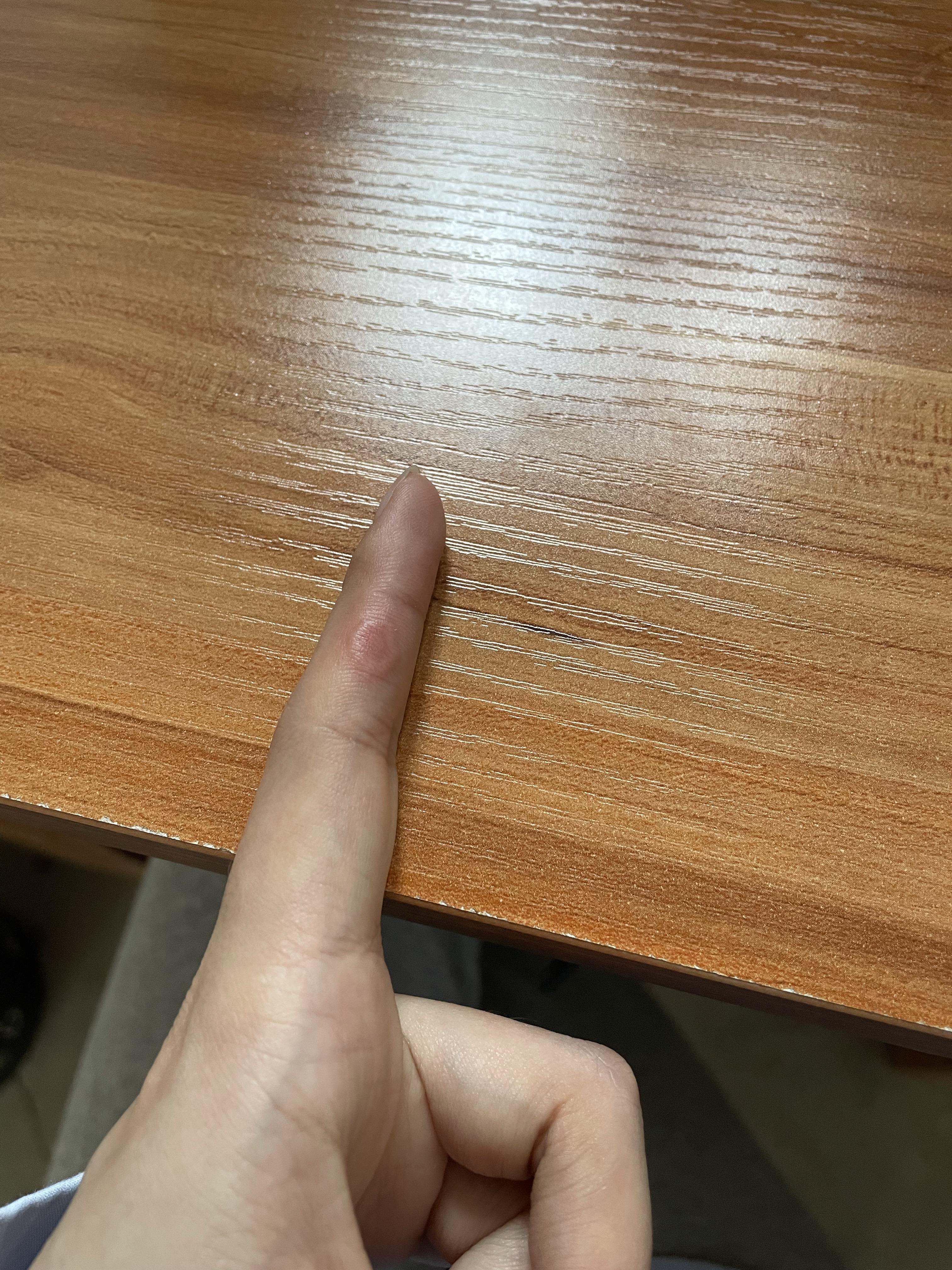 环状肉芽肿是由于压力引起的吗