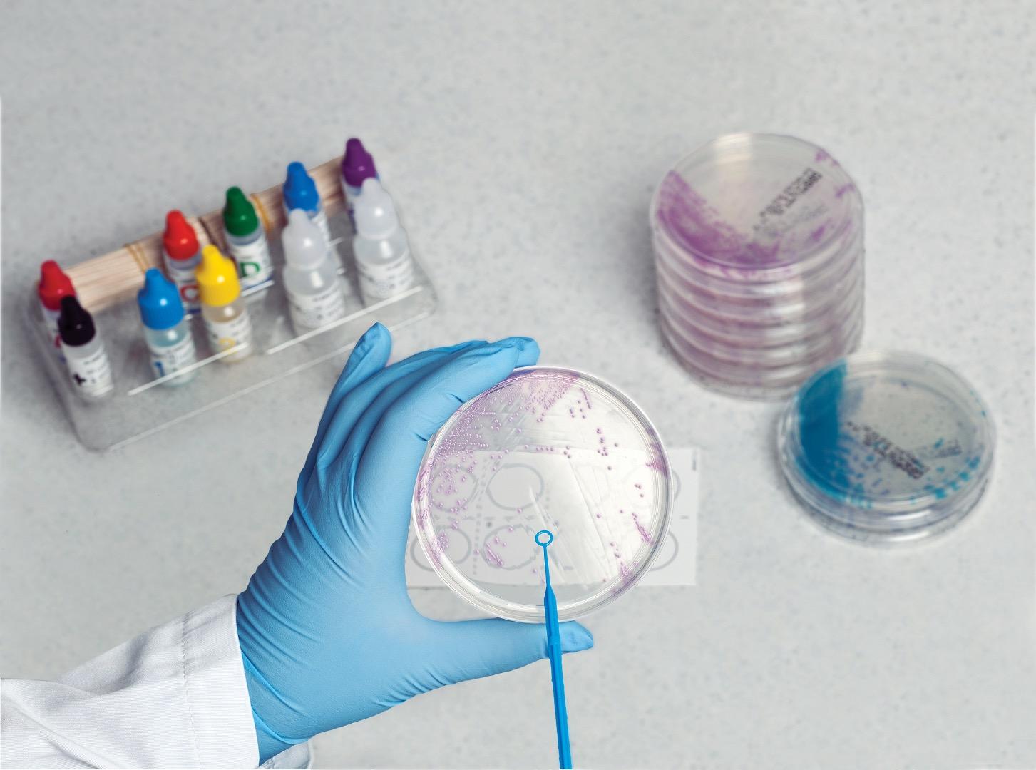 远离母婴杀手!谈美国产检之b型链球菌gbs筛查