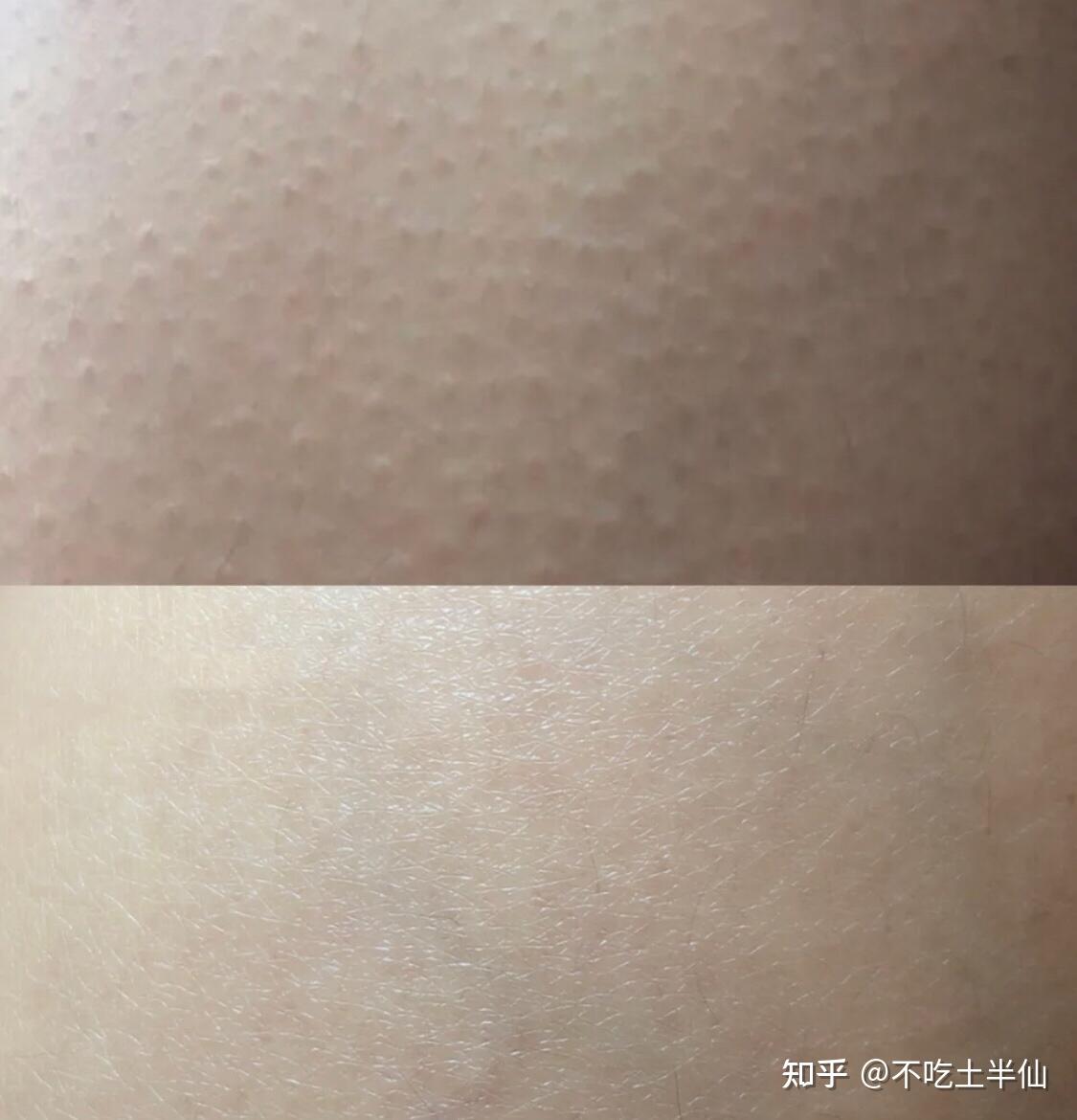鸡皮肤礼包汗毛(怎么买吃鸡皮肤)