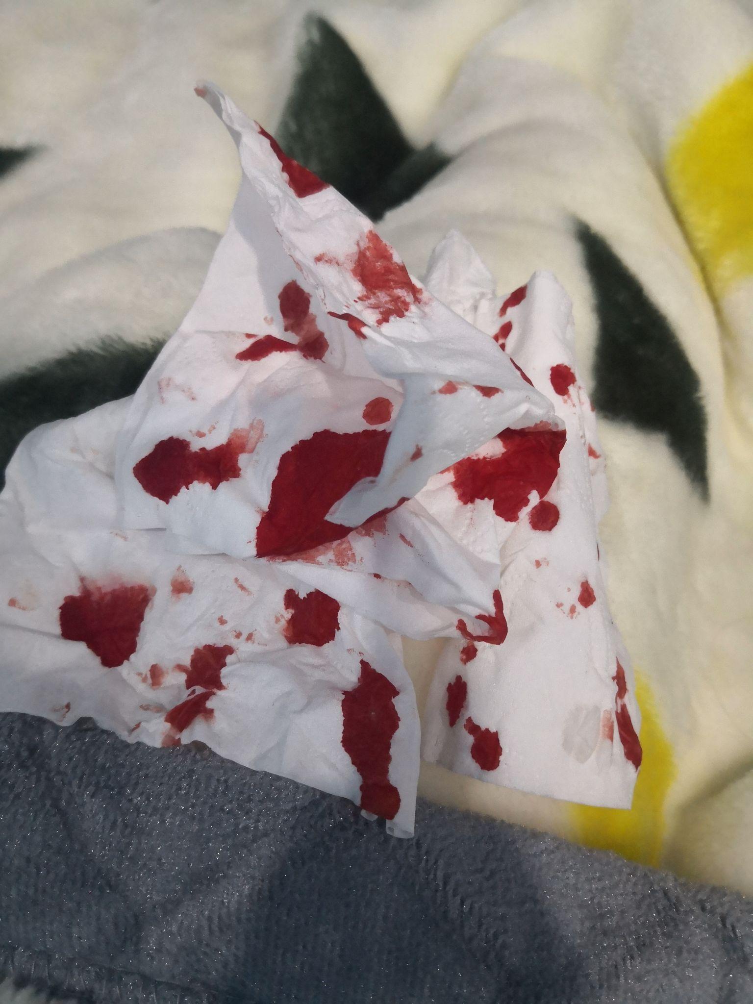 纸巾上面有鼻血的照片图片
