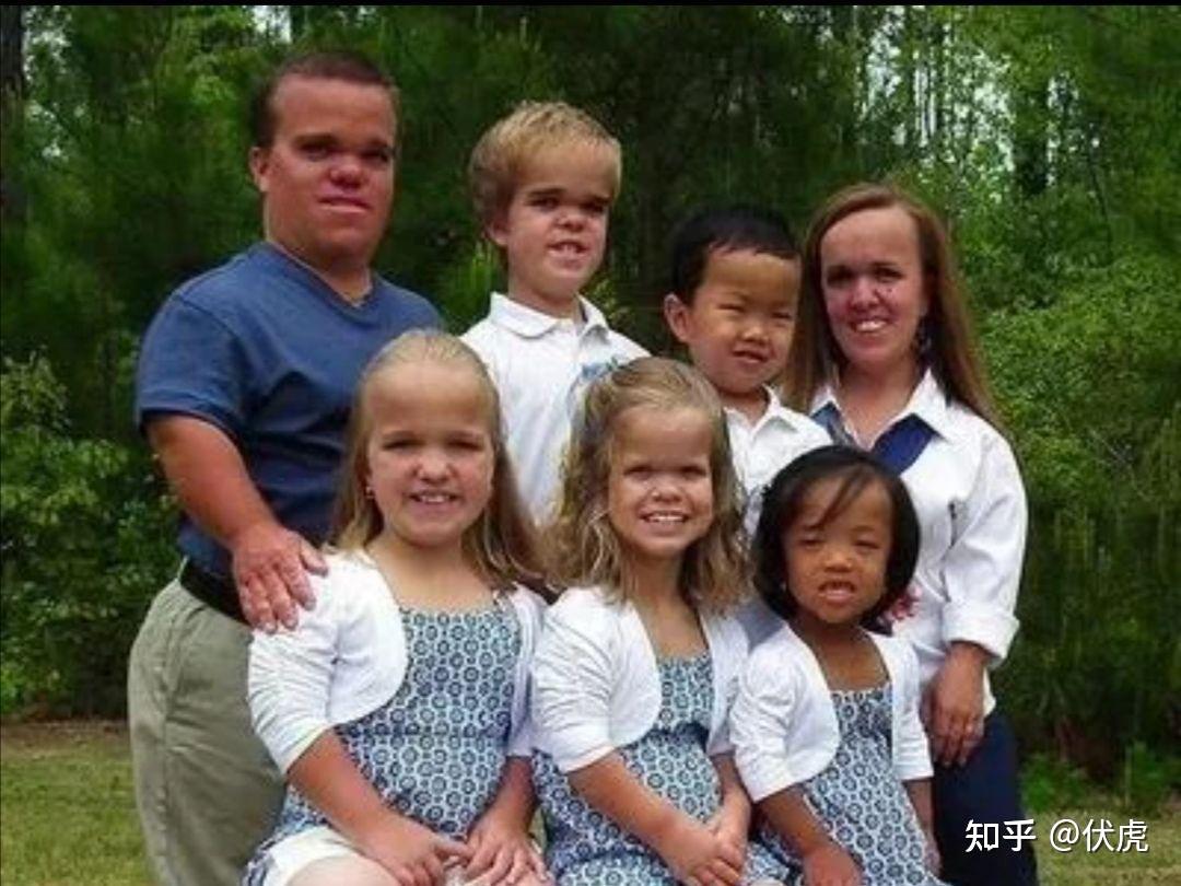 西式奇幻中的人类,矮人,半身人,侏儒除了身高上的区别外,它们的其它生理特征(新陈代谢或器官)都一样吗? - 知乎