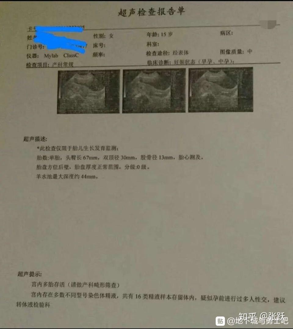 涕泪横流!婚检gpal是什么意思"灯火辉煌-第2张图片-贺发网