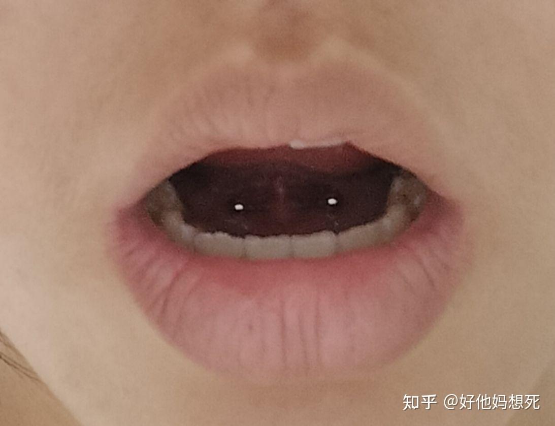 戴舌钉是一种怎样的体验? - 知乎