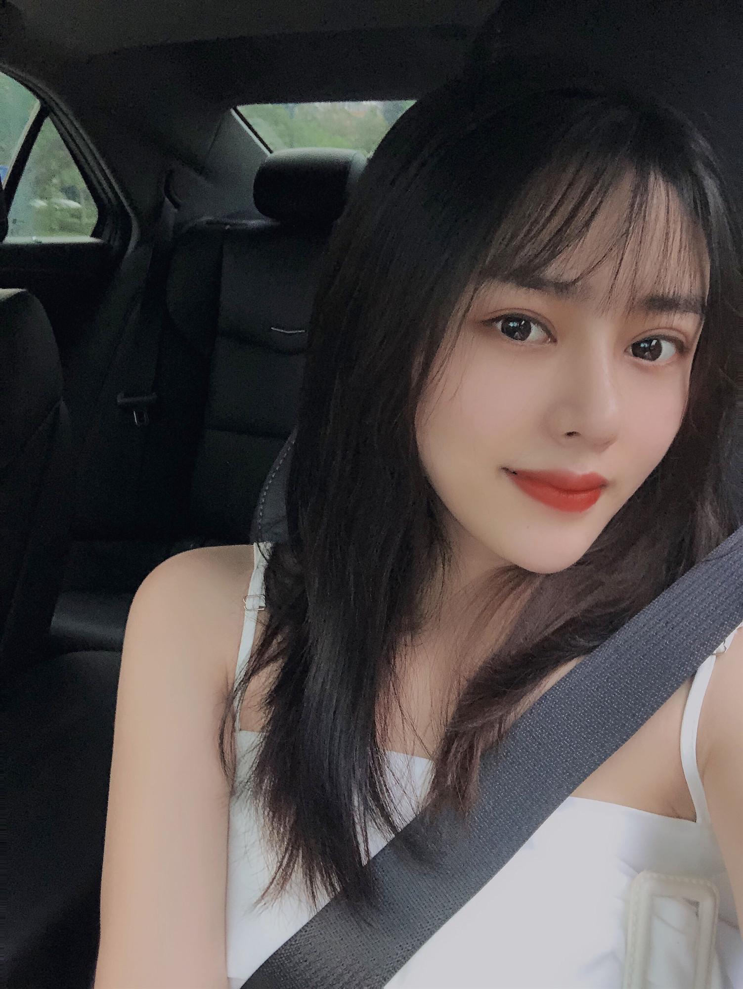 一个深圳妹子做完鼻综合的案例分享