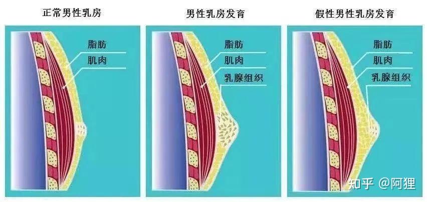 求助大神这是雌化还是脂肪胸