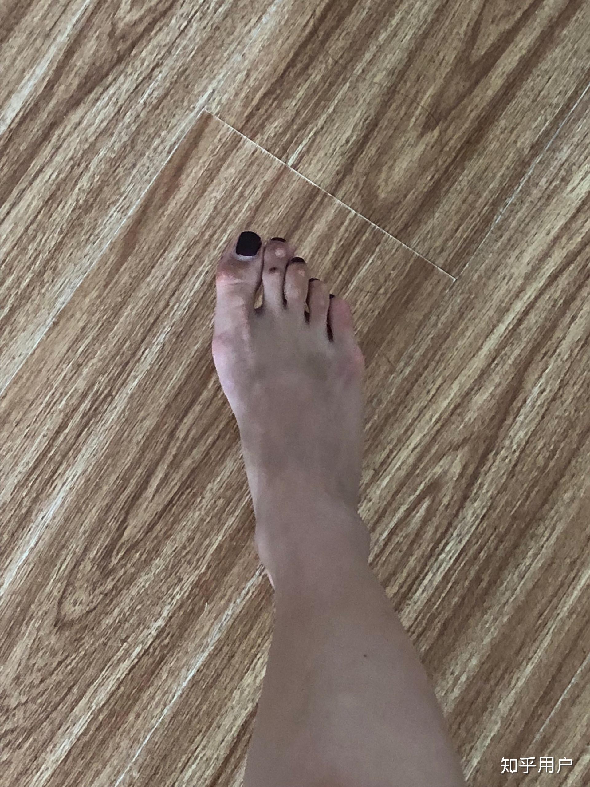 女生脚丑是种什么样的体验? - 知乎