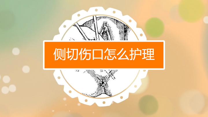 顺产妈妈的难言之隐——侧切伤口如何护理? - 知乎
