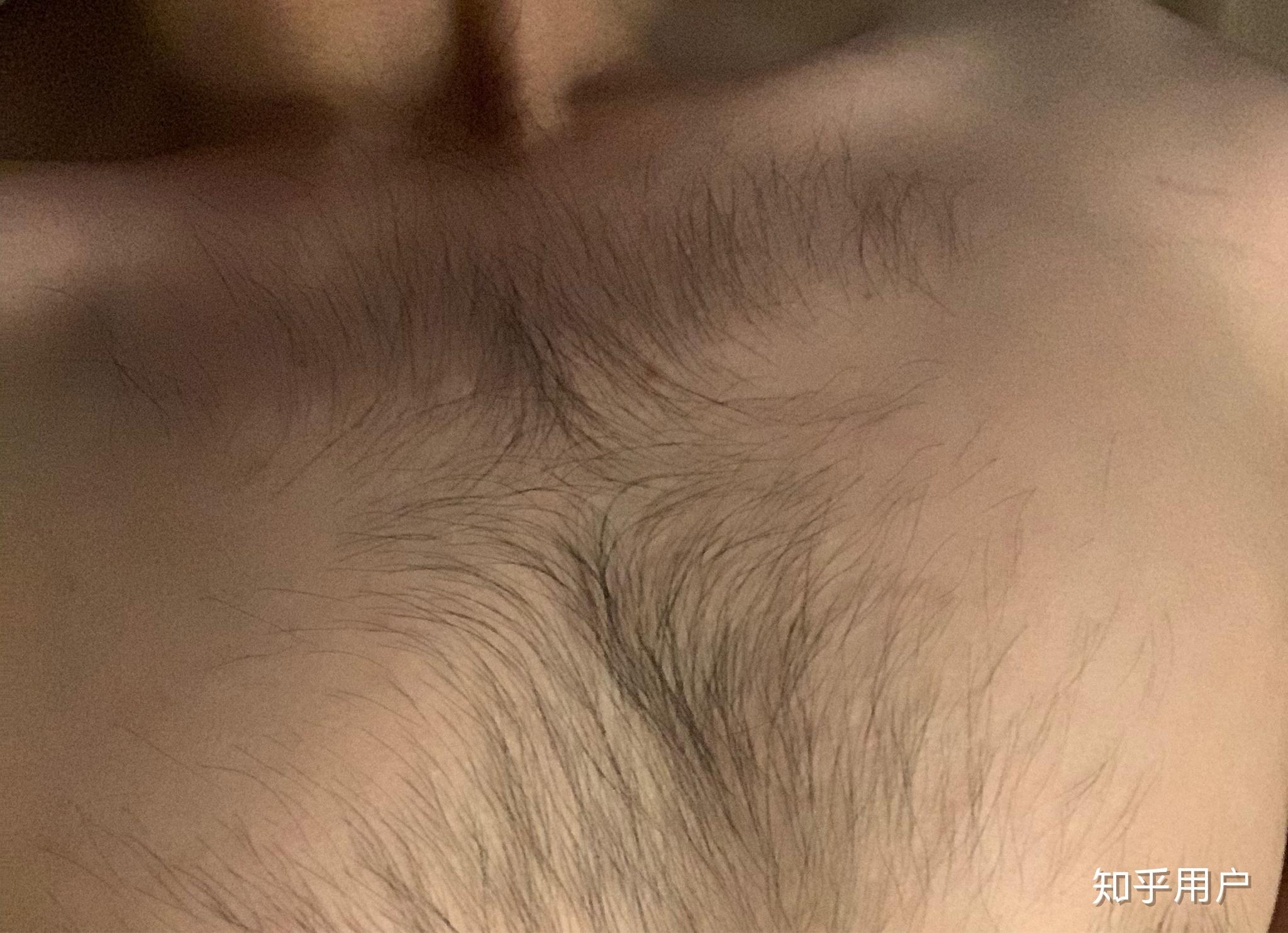 国人男性中鲜有胸毛,较茂密的更少,大多是在肚脐附近有点毛.