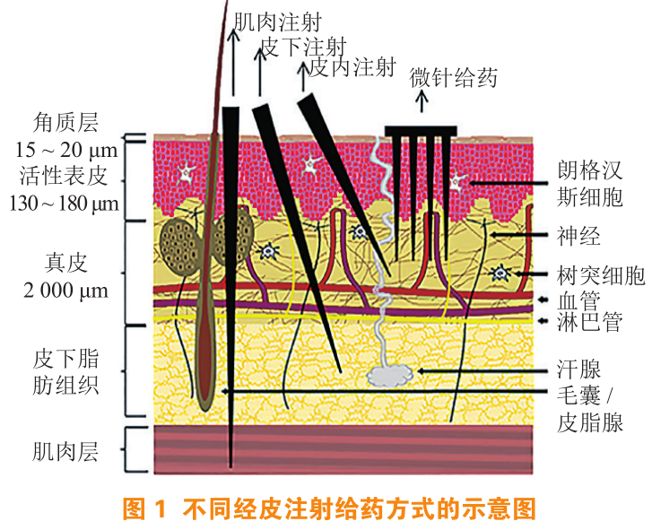 透皮新技术--可溶性微针 - 知乎