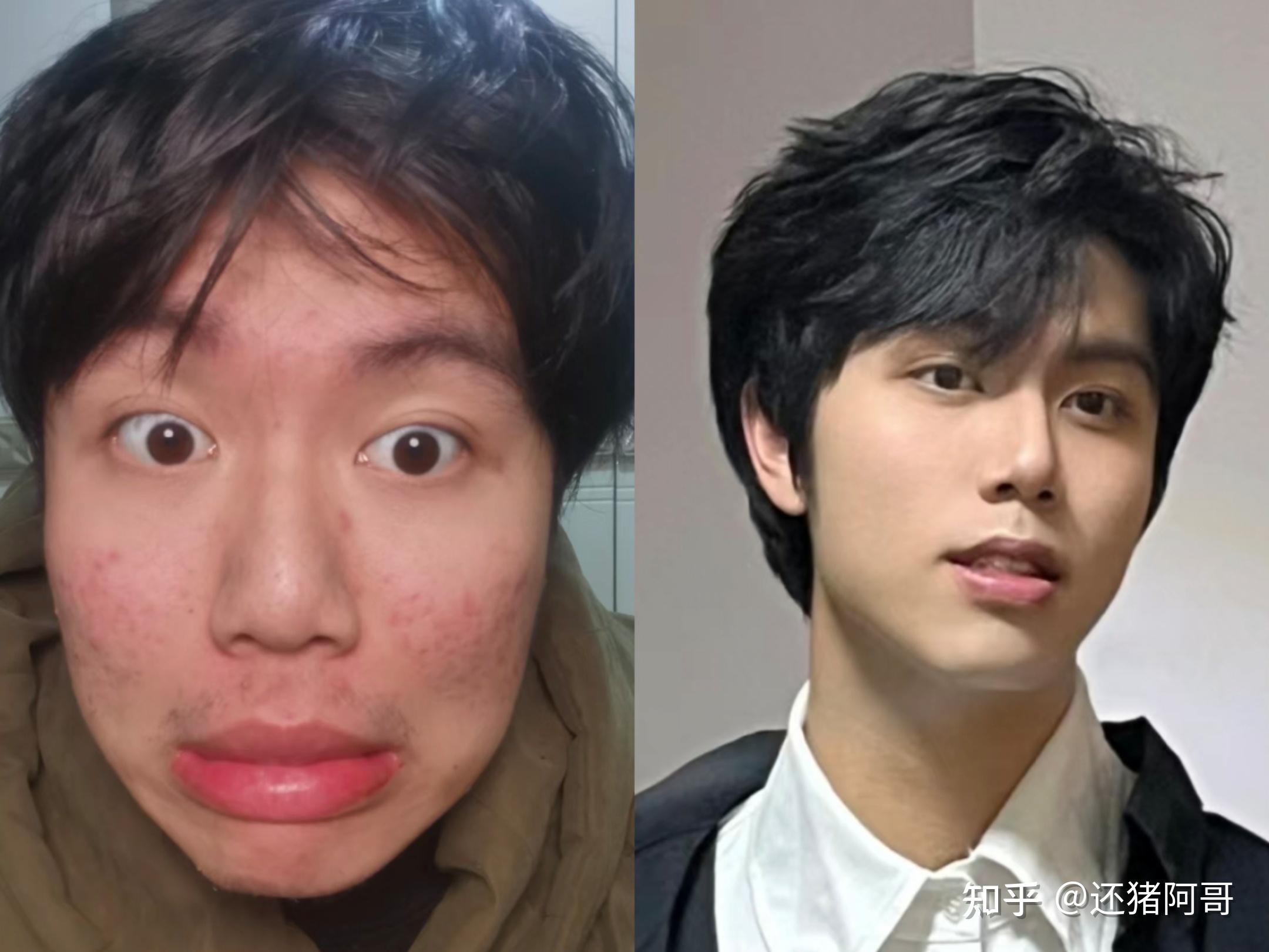 为什么生男孩会变丑的原因为什么在线