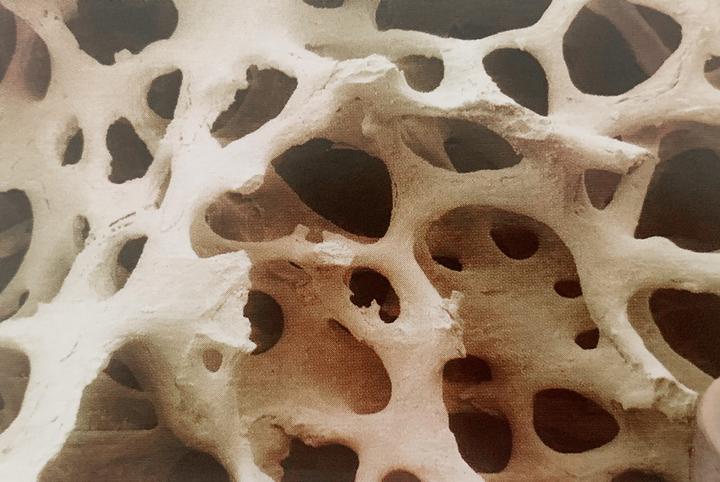 inside bones 02 – spongy bone