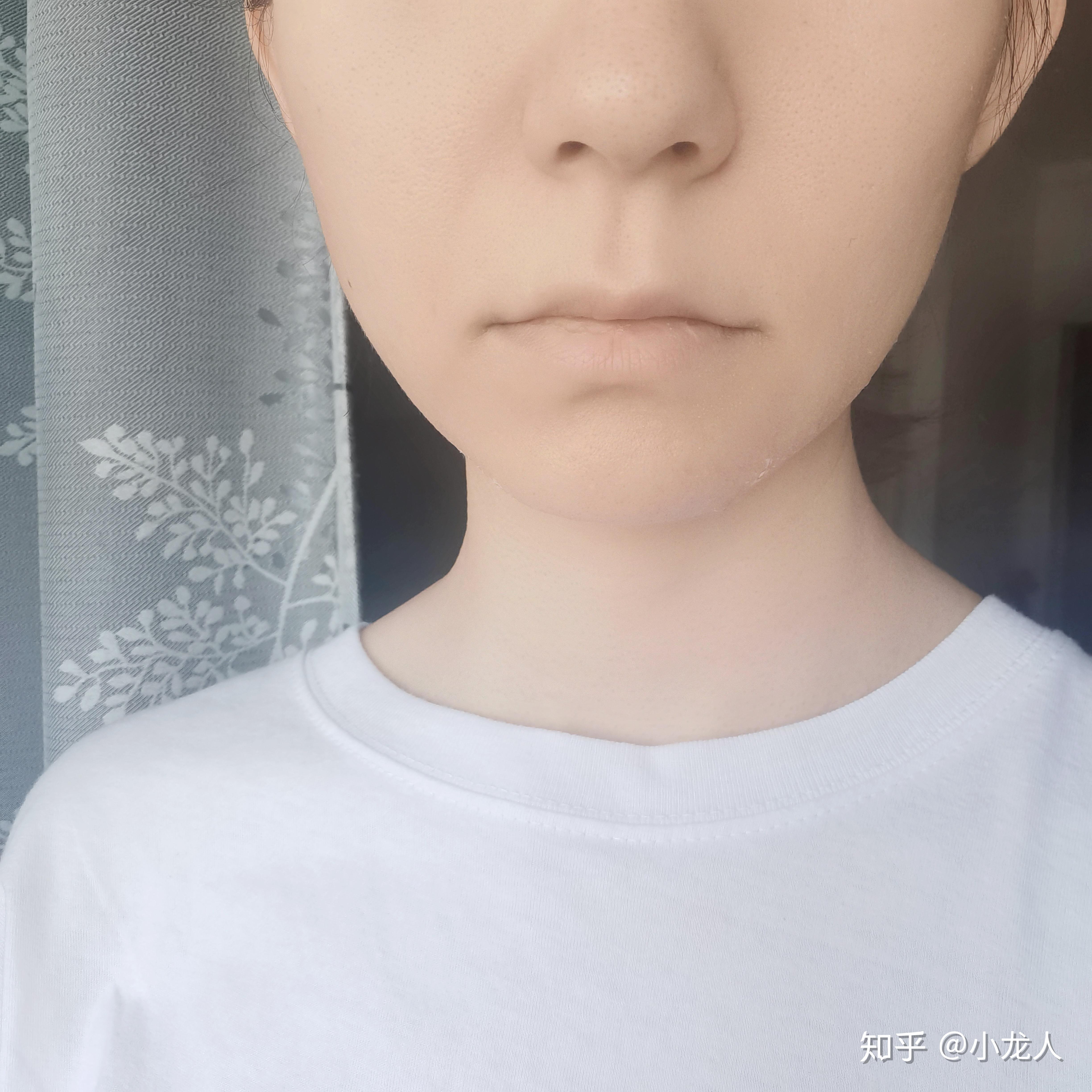 我的嘴唇很白没有一点血色可是又不贫血是为什么