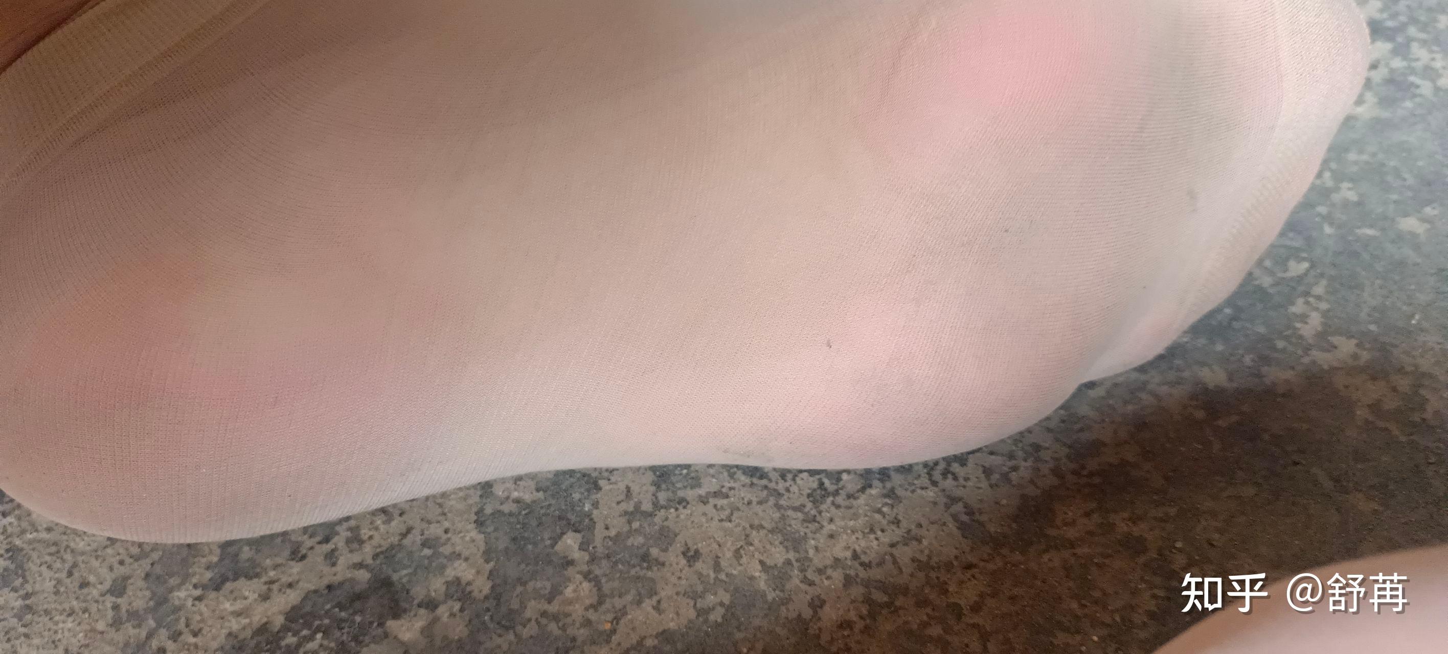 脚底长茧子穿超薄丝袜的脚底是怎么样的呢