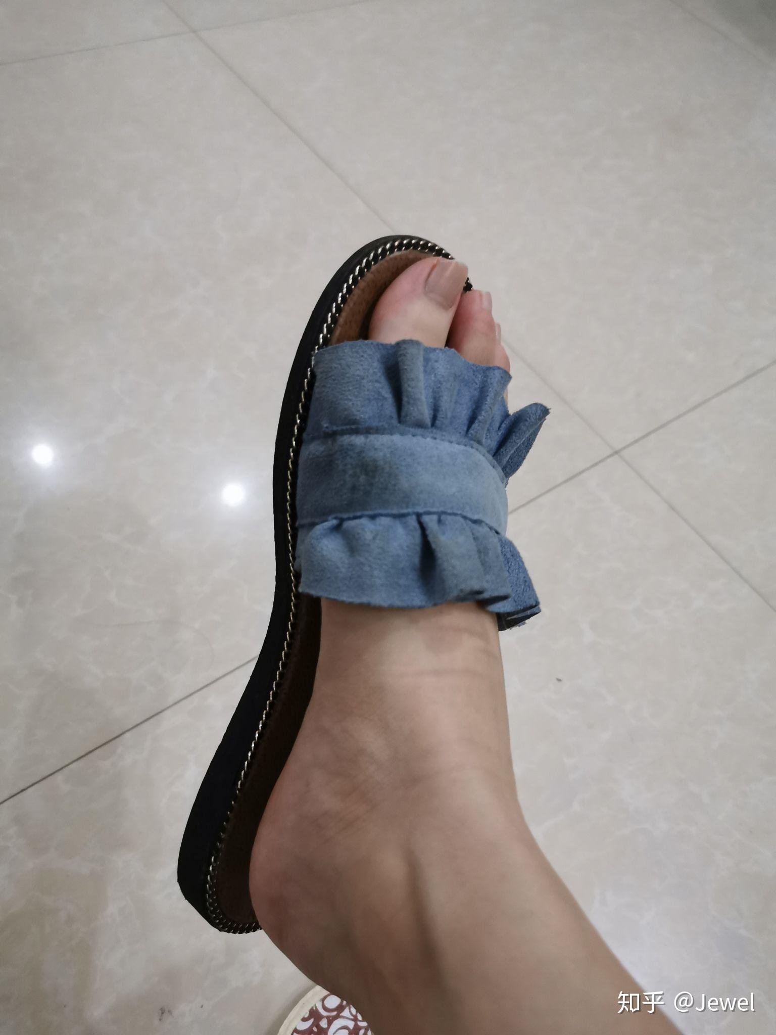我有拇外翻是遗传的穿什么样的鞋既遮丑又舒服呢