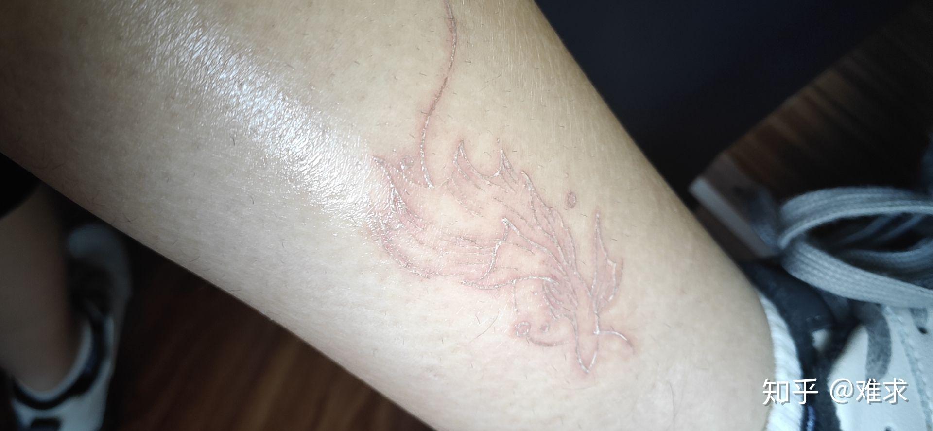 想纹个白色的纹身 有纹过白色的纹身的吗 有什么缺点吗?